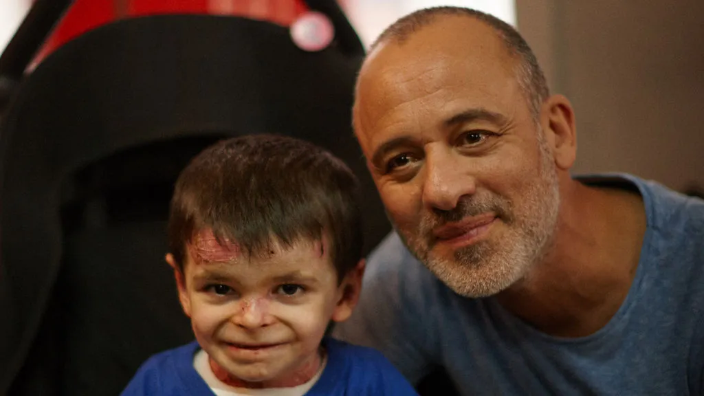 ESPAÑA LOGRA UN HITO HISTÓRICO EN LA LUCHA CONTRA LA "PIEL DE MARIPOSA" TRAS EL GRITO DE LEO EN BRUSELAS image