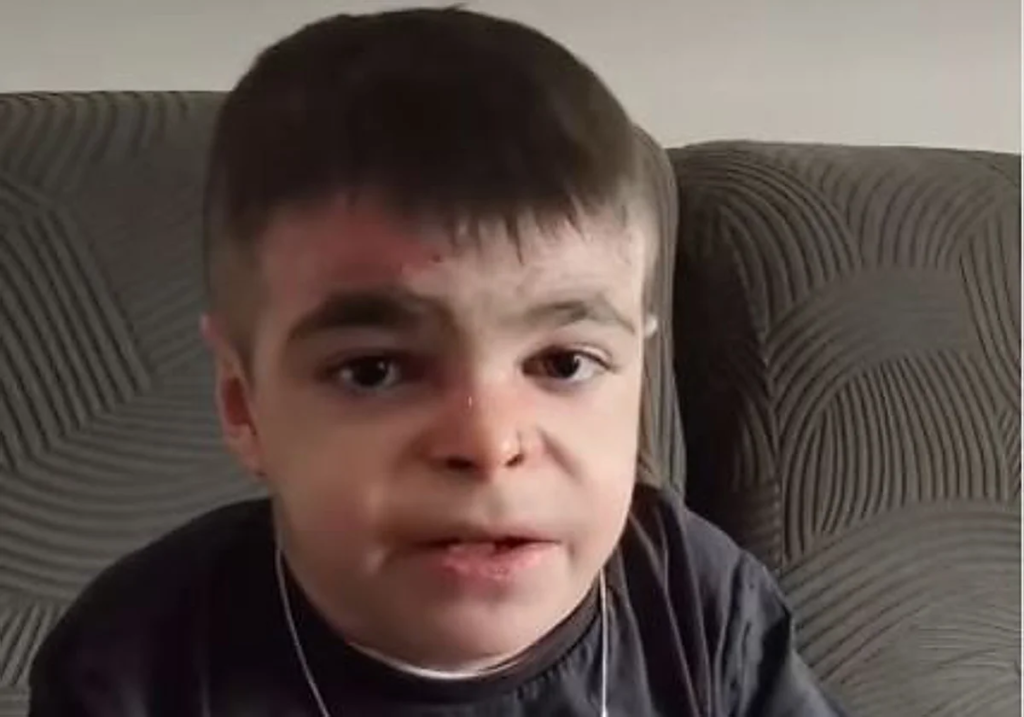 ESPAÑA LOGRA UN HITO HISTÓRICO EN LA LUCHA CONTRA LA "PIEL DE MARIPOSA" TRAS EL GRITO DE LEO EN BRUSELAS image